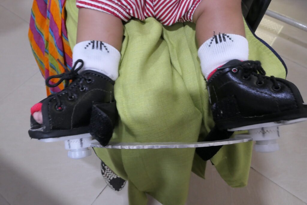 brace